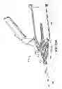 Fig. 25 - Flashback blood collection needle