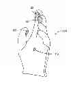 Fig. 01 - METHOD AND APPARATUS FOR MEDICAL DIAGNOSIS