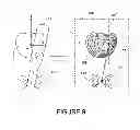 Fig. 10 - METHOD AND DEVICE FOR REAL TIME MECHANICAL IMAGING OF PROSTATE