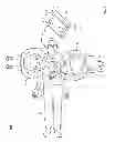 Fig. 02 - Out of phase chest compression and ventilation