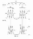 Fig. 03 - DEVICE AND METHOD FOR PULSED ACOUSTICAL STIMULATION OF THE BRAIN