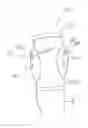 Fig. 01 - Bladder device and brace apparatuses comprising the bladder device