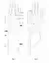 Fig. 06 - SPIRAL BRACE