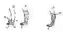 Fig. 01 - Elastic Bandage