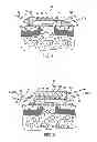 Fig. 05 - Wound care method and system with one or both of vacuum-light therapy and thermally augmented oxygenation