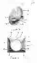 Fig. 03 - Breast pump