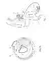 Fig. 10 - PUMPING BREAST MILK