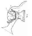 Fig. 19 - PUMPING BREAST MILK