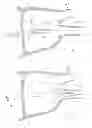Fig. 04 - Adaptable device for electrically isolating pulmonary veins in atrial fibrillation