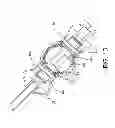 Fig. 05 - Medical apparatus and method of making the same