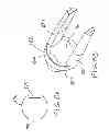 Fig. 06 - Catheter assembly and components thereof