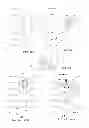 Fig. 05 - DEVICES FOR PUNCTURING FOR A HUMAN OR ANIMAL BODY'S MEMBRANE