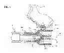 Fig. 10 - Controlled release structure for attaching medical devices