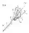 Fig. 16 - Controlled release structure for attaching medical devices