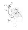 Fig. 02 - Sub-atmospheric wound-care system