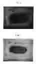 Fig. 03 - Absorbent article