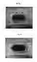 Fig. 04 - Absorbent article