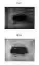 Fig. 05 - Absorbent article