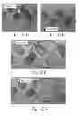 Fig. 28 - Web Material(s) For Absorbent Articles