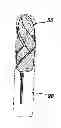 Fig. 01 - Fluid Management Device with Fluid Transport Element for use within a Body