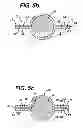 Fig. 06 - Fluid Management Device with Fluid Transport Element for use within a Body