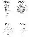 Fig. 09 - Fluid Management Device with Fluid Transport Element for use within a Body