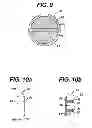 Fig. 10 - Fluid Management Device with Fluid Transport Element for use within a Body