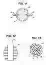 Fig. 11 - Fluid Management Device with Fluid Transport Element for use within a Body
