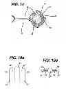 Fig. 12 - Fluid Management Device with Fluid Transport Element for use within a Body
