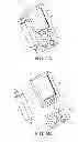 Fig. 06 - Integrated insulin delivery system with continuous glucose sensor