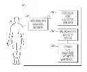 Fig. 01 - Integrated insulin delivery system with continuous glucose sensor