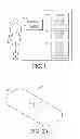 Fig. 02 - Integrated insulin delivery system with continuous glucose sensor