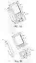 Fig. 06 - Integrated insulin delivery system with continuous glucose sensor