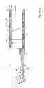 Fig. 04 - Guide extension catheter