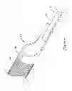 Fig. 08 - Guide extension catheter