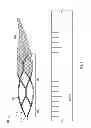 Fig. 08 - Devices and systems for thrombus treatment
