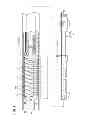 Fig. 02 - Self-expanding interposed member spacing protective sleeve from restenosis restraining agent coated balloon catheter