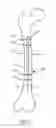 Fig. 09 - LIMB LENGTHENING APPARATUS AND METHODS