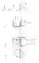 Fig. 11 - Patient-specific trial repositioning block