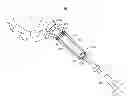 Fig. 01 - Patient-matched acetabular alignment tool