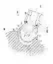 Fig. 06 - Patient-matched acetabular alignment tool