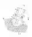 Fig. 08 - Patient-matched acetabular alignment tool