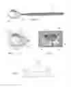 Fig. 02 - Positioning device for eye surgery and procedures
