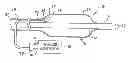 Fig. 01 - Shock wave catheter system with arc preconditioning