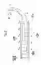 Fig. 06 - Cochlear implant electrode assembly insertion tool