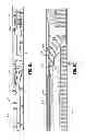 Fig. 41 - Endoscopic surgical clip applier