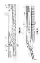 Fig. 43 - Endoscopic surgical clip applier