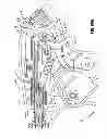 Fig. 44 - Endoscopic surgical clip applier
