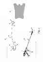 Fig. 02 - IMPLANTABLE SUPPORT ATTACHMENT SYSTEM AND ASSEMBLY