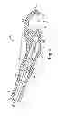 Fig. 06 - IMPLANTABLE SUPPORT ATTACHMENT SYSTEM AND ASSEMBLY